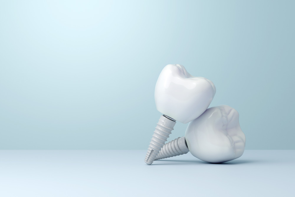 dental implant