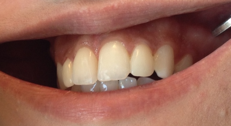 original image after