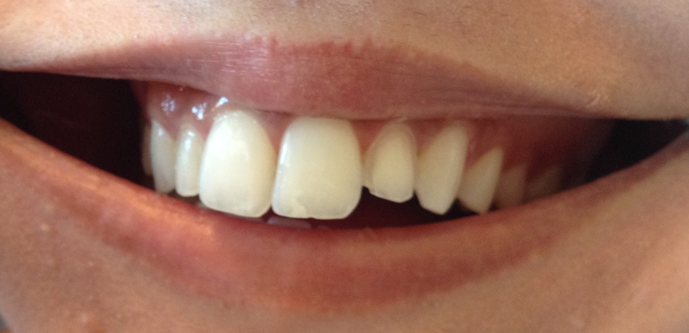 original image before