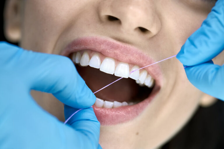 Delightful girl in a dental clinic. Dentist in blue latex gloves is flossing her teeth with a help of a dental floss. Closeup horizontal photo.