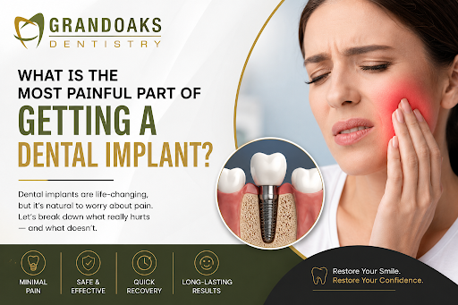 Dental Implant