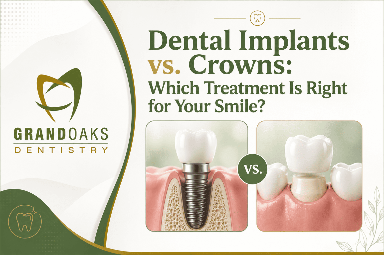 Dental Implants vs Crowns